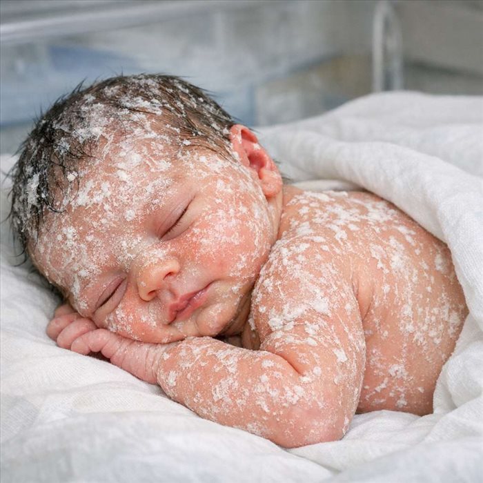 Vernix caseosa sur la peau du bébé : rôle et utilité